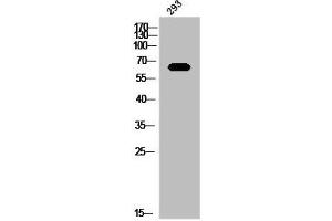 Western Blot analysis of 293 cells using Mena Polyclonal Antibody (ENAH antibody  (C-Term))