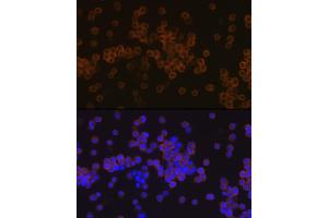 Immunofluorescence analysis of Raw 264 7 cells using PLC gamma 2 (PLC gamma 2 (PLCG2)) Rabbit mAb (ABIN7269342) at dilution of 1:100 (40x lens). (Phospholipase C gamma 2 antibody)