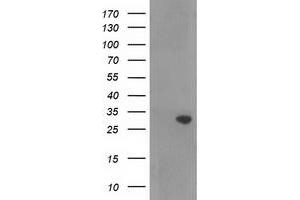 HEK293T cells were transfected with the pCMV6-ENTRY control (Left lane) or pCMV6-ENTRY RASSF5 (Right lane) cDNA for 48 hrs and lysed. (RASSF5 antibody)