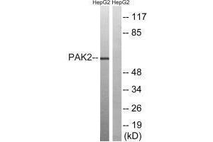 Western blot analysis of extracts from HepG2 cells, treated with serum (20 % , 15 mins), using PAK2 (Ab-192) antibody. (PAK2 antibody  (Ser192))