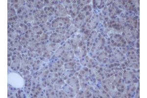 Image no. 4 for anti-DEAD (Asp-Glu-Ala-Asp) Box Polypeptide 59 (DDX59) (AA 1-303) antibody (ABIN1490728)