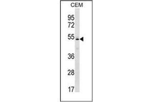 Western blot analysis of KCNJ4 Antibody (N-term) in CEM cell line lysates (35ug/lane).