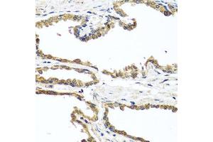 Immunohistochemistry of paraffin-embedded human prostate using OGFR antibody (ABIN5974255) at dilution of 1/100 (40x lens). (OGFR antibody)