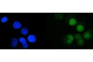 IF analysis of MRE11 using anti-MRE11 antibody (ABIN7600025). (Mre11 antibody  (AA 14-481))