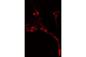 ABIN6278630 staining  NIH-3T3 cells by IF/ICC. (URI1 antibody  (Internal Region))