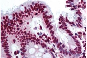 Human Colon (formalin-fixed, paraffin-embedded) stained with THRAP3 antibody ABIN290234 at 10 ug/ml followed by biotinylated goat anti-rabbit IgG secondary antibody ABIN481713, alkaline phosphatase-streptavidin and chromogen. (THRAP3 antibody  (AA 930-955))