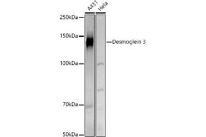 Western blot analysis of extracts of various cell lines, using Desmoglein 3 antibody (ABIN6127804, ABIN6139833, ABIN6139834 and ABIN6224465) at 1:500 dilution. (Desmoglein 3 antibody  (AA 749-999))