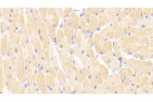 Detection of cTnI in Mouse Cardiac Muscle Tissue using Polyclonal Antibody to Cardiac Troponin I (cTnI) (TNNI3 antibody  (AA 1-211))