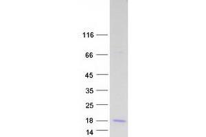 Western Blotting (WB) image for Gonadotropin-Releasing Hormone 2 (GnRH2) (Transcript Variant 1) protein (Myc-DYKDDDDK Tag) (ABIN2722116)