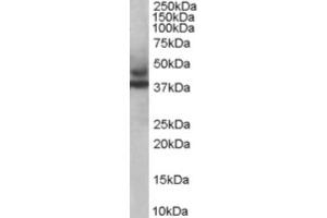 Western Blotting (WB) image for anti-Tripartite Motif Containing 54 (TRIM54) (C-Term) antibody (ABIN2465974) (TRIM54 antibody  (C-Term))