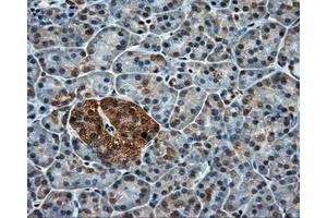Immunohistochemical staining of paraffin-embedded colon tissue using anti-PPP5C mouse monoclonal antibody.