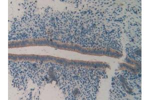 IHC-P analysis of Mouse Uterus Tissue, with DAB staining. (ITGA2 antibody  (AA 212-370))