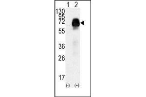 Western blot analysis of AMHR2(arrow) using rabbit polyclonal AMHR2 Antibody