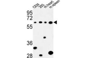 Western Blotting (WB) image for anti-Phospholipase C zeta 1 (PLCz1) antibody (ABIN3004174) (PLCz1 antibody)