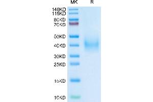 Human uPAR Domain (2+3) on Tris-Bis PAGE under reduced condition. (PLAUR Protein (AA 115-305) (His tag))