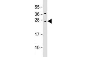 Western blot testing of human HepG2 cell lysate with CIDE B antibody at 1:2000. (CIDEB antibody  (AA 150-183))