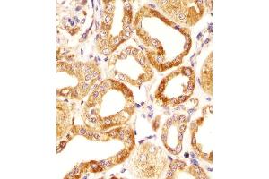Immunohistochemical analysis of paraffin-embedded H. (HAS2 antibody  (AA 138-166))