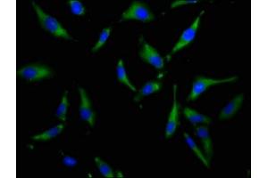 Immunofluorescence staining of Hela cells with ABIN7169994 at 1:100, counter-stained with DAPI. (SLC34A3 antibody  (AA 1-76))