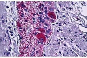 Human Colon, Peripheral Nerve: Formalin-Fixed, Paraffin-Embedded (FFPE) (DPYSL2 antibody  (AA 480-529))