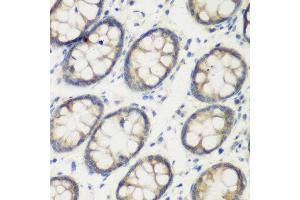Immunohistochemistry of paraffin-embedded human colon using TGM5 antibody at dilution of 1:200 (40x lens). (Transglutaminase 5 antibody)