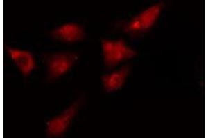ABIN6275012 staining  HeLa cells by IF/ICC. (KIF4A antibody  (C-Term))