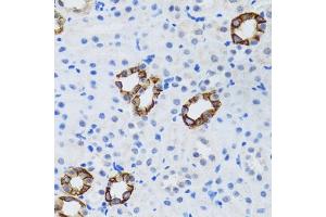 Immunohistochemistry of paraffin-embedded mouse kidney using GABARAP antibody (ABIN6129966, ABIN6140874, ABIN6140877 and ABIN6221250) at dilution of 1:100 (40x lens). (GABARAP antibody  (AA 1-117))