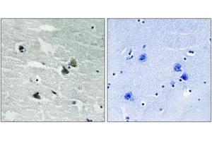 Immunohistochemistry analysis of paraffin-embedded human brain, using MER/SKY (Phospho-Tyr749/681) Antibody. (MER/SKY (AA 716-765), (pTyr749) antibody)