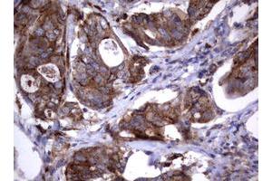 Image no. 2 for anti-Sialidase 1 (Lysosomal Sialidase) (NEU1) (AA 48-315) antibody (ABIN1491548) (NEU1 antibody  (AA 48-315))