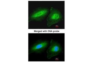 ICC/IF Image Immunofluorescence analysis of paraformaldehyde-fixed HeLa, using CCDC83, antibody at 1:200 dilution. (CCDC83 antibody)