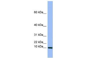 WB Suggested Anti-SEMG1 Antibody Titration:  0. (SEMG1 antibody  (Middle Region))