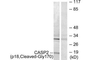 Western Blotting (WB) image for anti-Caspase 2, Apoptosis-Related Cysteine Peptidase (CASP2) (Cleaved-Gly170) antibody (ABIN1853490) (Caspase 2 antibody  (Cleaved-Gly170))