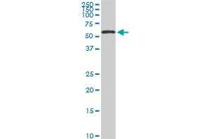 HDAC1 monoclonal antibody (M02), clone 3E1 Western Blot analysis of HDAC1 expression in Hela S3 NE . (HDAC1 antibody  (AA 1-482))
