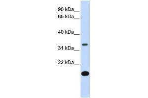 WB Suggested Anti-FST Antibody Titration:  0. (Follistatin antibody  (Middle Region))