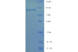 SDS-PAGE (SDS) image for Interferon Regulatory Factor 8 (IRF8) (AA 1-424), (full length) protein (His-SUMO Tag) (ABIN5709767)