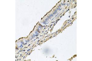 Immunohistochemistry of paraffin-embedded human trachea using DSG1 antibody (ABIN6003544) at dilution of 1/100 (40x lens). (Desmoglein 1 antibody)