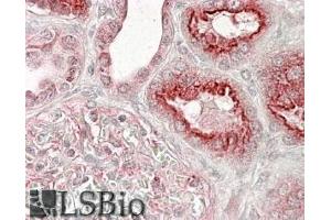 ABIN185427 (3. (VPS11 antibody  (Internal Region))