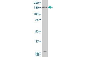 NOS1 polyclonal antibody (A01), Lot # 060105JC01 Western Blot analysis of NOS1 expression in SJCRH30 . (NOS1 antibody  (AA 1041-1150))