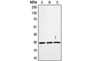 Western blot analysis of TWEAK expression in SKNSH (A), WI38 (B), HuvEc (C) whole cell lysates. (TWEAK antibody  (Center))