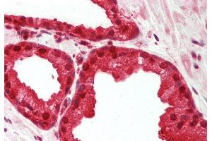Rabbit Anti-MAT2A antibody Catalog Number: ARP46144 Formalin Fixed Paraffin Embedded Tissue: Human Prostate Primary antibody Concentration: 1:200 Secondary Antibody: Donkey anti-Rabbit-Cy3 Secondary Antibody Concentration: 1:200 Magnification: 20x Exposure Time: 0. (MAT2A antibody  (Middle Region))