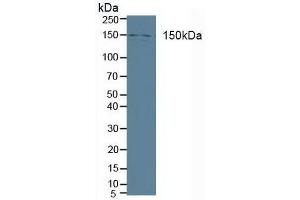 Detection of PLCb3 in Human A431 cells using Polyclonal Antibody to Phospholipase C Beta 3, Phosphoinositide Specific (PLCb3) (Phospholipase C beta 3, Phosphoinositide Specific (AA 318-468) antibody)