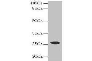 Western blot All lanes: CSHL1 antibody at 2 μg/mL + Human placenta tissue Secondary Goat polyclonal to rabbit IgG at 1/10000 dilution Predicted band size: 26, 23, 16, 15 kDa Observed band size: 26 kDa (CSHL1 antibody  (AA 1-128))