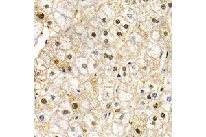 Immunohistochemistry of paraffin-embedded human liver injury using RAD9A antibody.