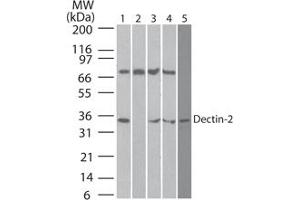 Image no. 2 for anti-C-Type Lectin Domain Family 6, Member A (CLEC6A) (AA 75-125) antibody (ABIN959984) (C-Type Lectin Domain Family 6, Member A (CLEC6A) (AA 75-125) antibody)