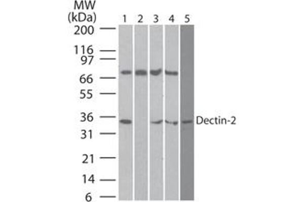 C-Type Lectin Domain Family 6, Member A (CLEC6A) (AA 75-125) Antikörper