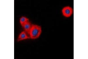 Immunofluorescent analysis of LCK staining in HeLa cells. (LCK antibody)