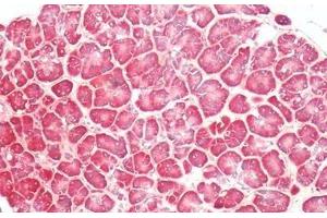 PTGER4 antibody  (C-Term)