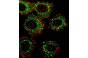 Fluorescent image of A549 cell stained with FADS2 Antibody (N-term) (ABIN656230 and ABIN2845545)/SA110322AN. (FADS2 antibody  (N-Term))