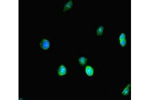 Immunofluorescence (IF) image for anti-SWI/SNF Related, Matrix Associated, Actin Dependent Regulator of Chromatin, Subfamily A, Member 4 (SMARCA4) (AA 808-1092) antibody (ABIN7172403)