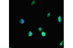 Immunofluorescent analysis of HepG2 cells using ABIN7172403 at dilution of 1: 100 and Alexa Fluor 488-congugated AffiniPure Goat Anti-Rabbit IgG(H+L) (SMARCA4 antibody  (AA 808-1092))