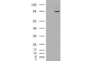 HEK293 overexpressing SMEK1 and probed with ABIN2560023 (mock transfection in first lane).
